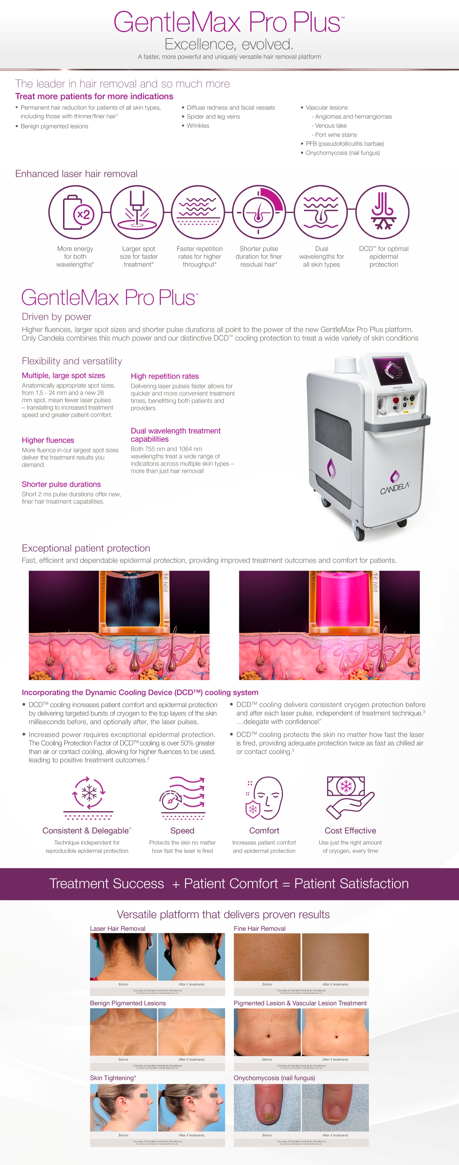 GentleMax Pro Plus